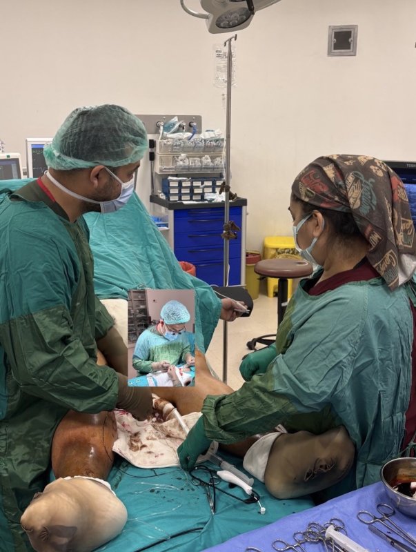 Tarsus Devlet Hastanesi’nde Varis Tedavisinde Bir İlk: RF Ablasyon Uygulandı