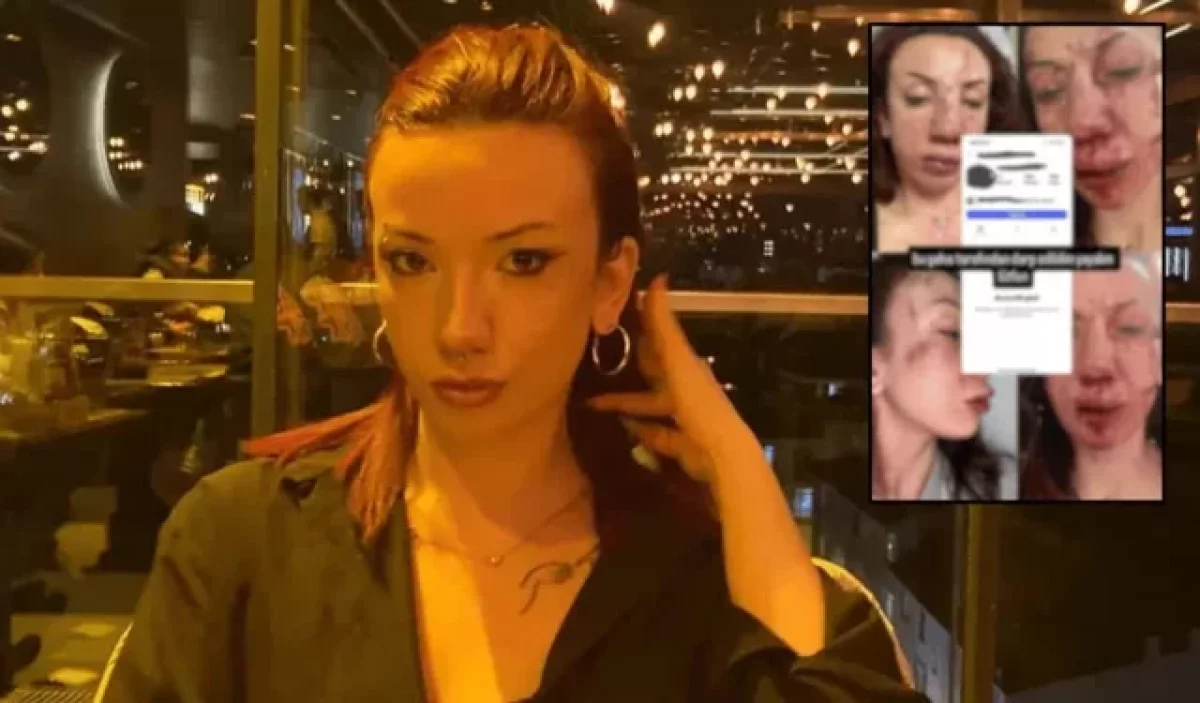 Eskişehir’de Genç Kadına Şiddet İddiası: Şüpheli Kaçtı